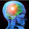 Causes of traumatic brain injury